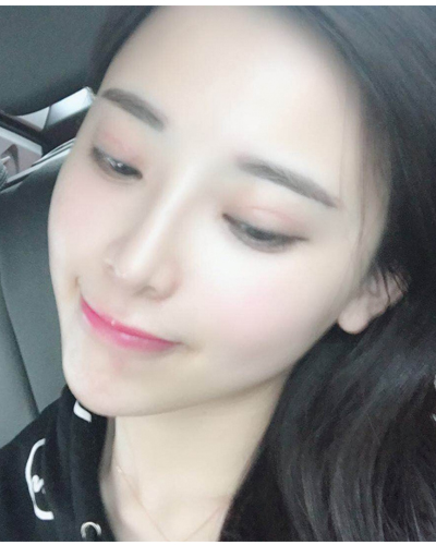 襄陽維多利亞整形醫(yī)院安邰晥醫(yī)生做鼻綜合整形怎么樣？附鼻綜合整形案例