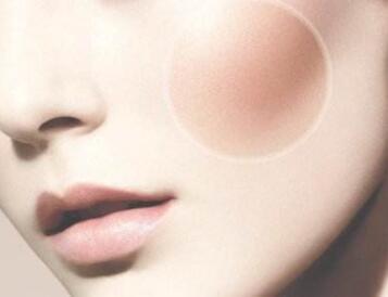 杭州靜港醫(yī)療美容診所顴骨整形