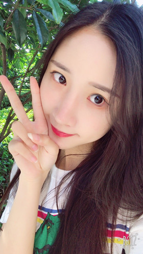 湛江澳泰整形醫(yī)院彭鑫醫(yī)生做自體脂肪豐蘋果肌+太陽(yáng)穴案例效果對(duì)比圖 湛江澳泰整形醫(yī)院彭鑫醫(yī)生做自體脂肪豐蘋果肌+太陽(yáng)穴案例效果對(duì)比圖