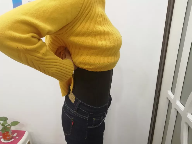 沈陽天使醫(yī)療整形醫(yī)生黃展翼做水動力腰腹吸脂技術(shù)怎么樣？附水動力腰腹吸脂案例