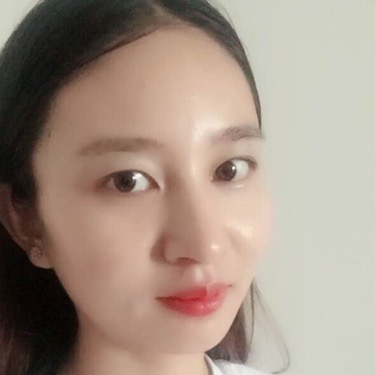 武漢維納斯整形醫(yī)院趙瑾醫(yī)生做玻尿酸墊下巴怎么樣？附玻尿酸墊下巴案例