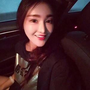 廣州柏德口腔蘭海龍醫(yī)生做瓷貼面效果怎么樣？廣州柏德口腔瓷貼面案例分享