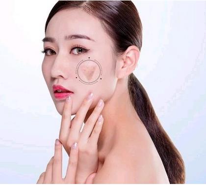 海口紅妝尚整形光子嫩膚