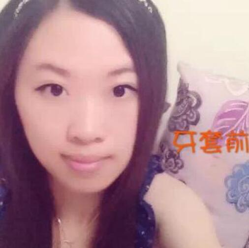 重慶嘉悅口腔醫(yī)院周繼祥醫(yī)生做金屬托槽矯正效果怎么樣？附案例效果對比圖