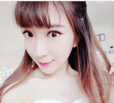 武漢中翰整形外科醫(yī)院陳志鵬醫(yī)生做雙眼皮修復(fù)效果怎么樣？附雙眼皮修復(fù)案例