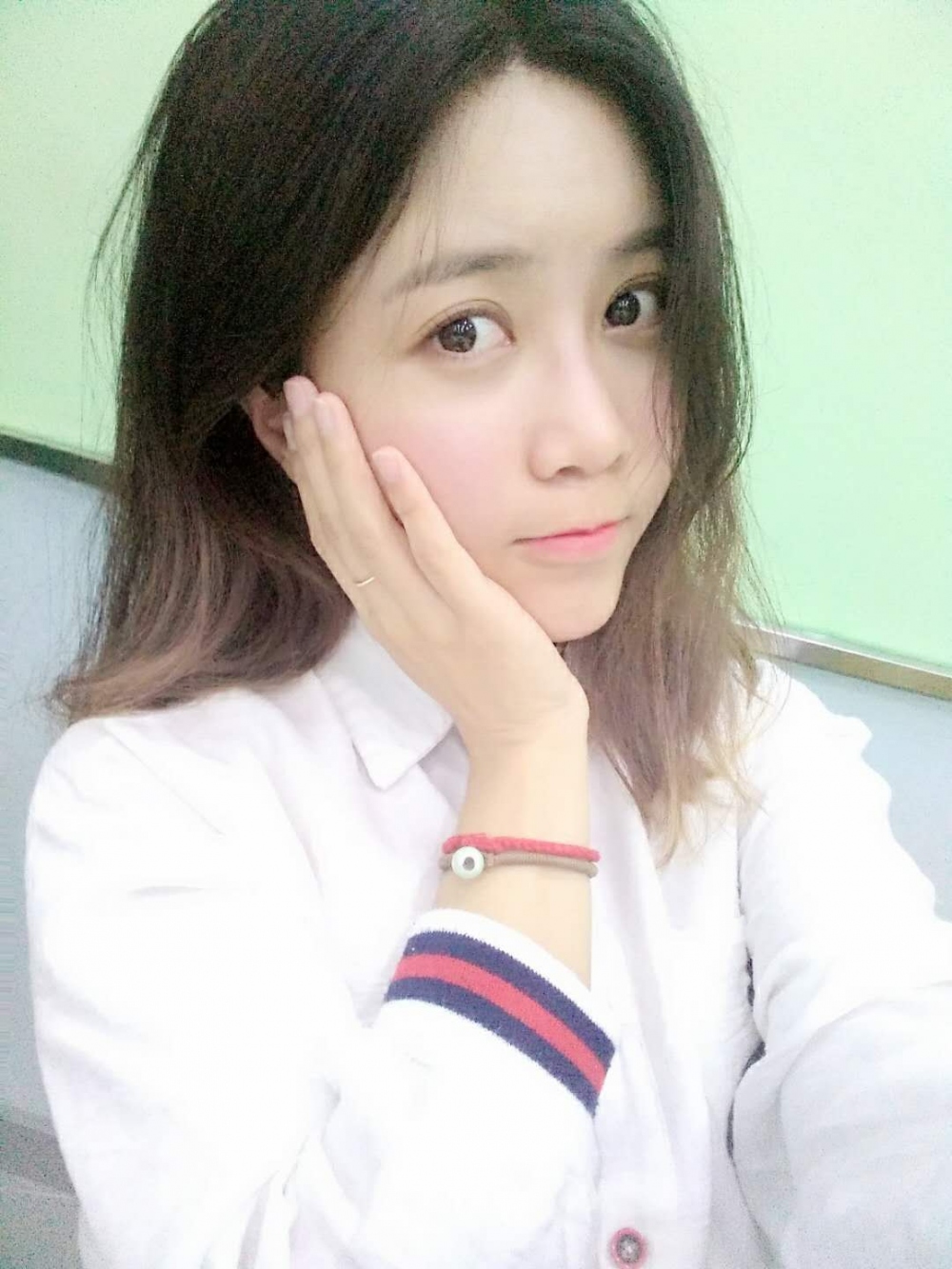 重慶美圣美邦整形醫(yī)院劉力維醫(yī)生做自體脂肪全臉填充案例效果對(duì)比圖 重慶美圣美邦整形醫(yī)院劉力維醫(yī)生做自體脂肪全臉填充案例效果對(duì)比圖