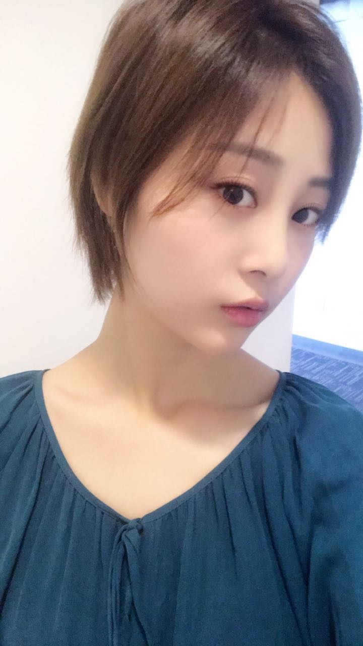 天津歐華威莎整形醫(yī)生姚玲做面部埋線提升效果怎么樣？附埋線提升案例