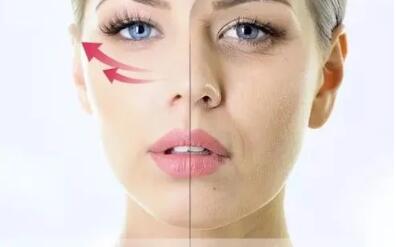 河北工程大學附屬醫(yī)院整形美容科彩光嫩膚