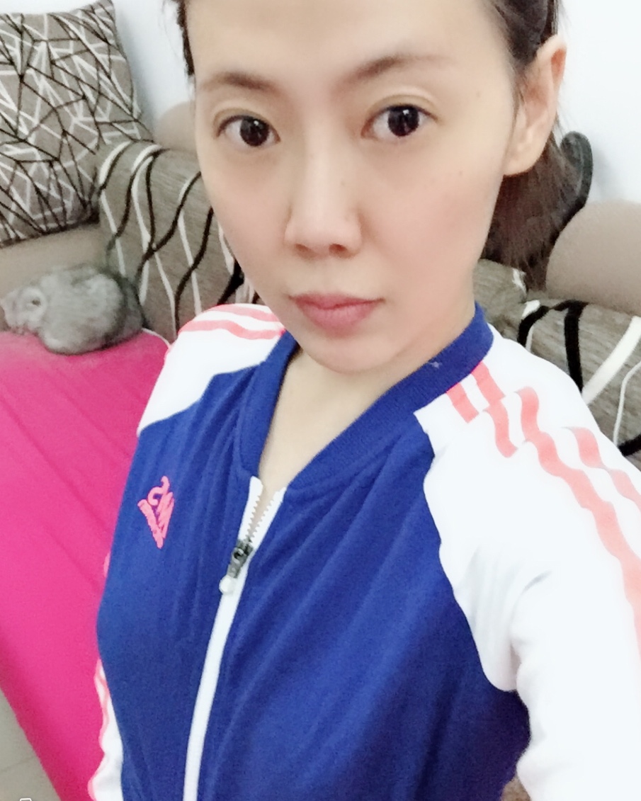 煙臺壹美整形醫(yī)院朱建瑩醫(yī)生做自體脂肪隆胸怎么樣？附自體脂肪隆胸案例