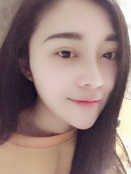 石家莊雅芳亞整形醫(yī)生王文明做雙眼皮+開眼角+鼻綜合整形案例效果對比圖