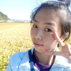 珠海蒂伊醫(yī)療整形醫(yī)生廖俊凱做激光祛斑效果怎么樣？附激光祛斑案例效果圖