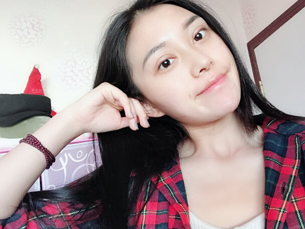 石家莊雅芳亞整形醫(yī)生王文明做雙眼皮+開眼角+鼻綜合整形案例效果對比圖 石家莊雅芳亞整形醫(yī)生王文明做雙眼皮+開眼角+鼻綜合整形案例效果對比圖