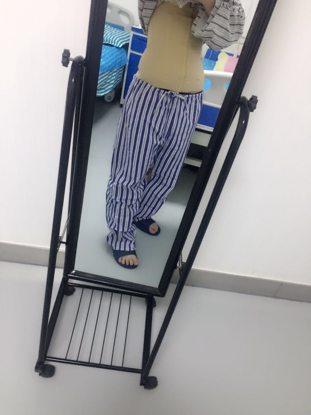 肇慶華美整形醫(yī)院陳巍醫(yī)生做腰腹吸脂效果怎么樣？附腰腹吸脂案例