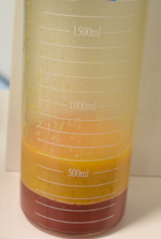 珠海海大整形美容外科黃發(fā)醫(yī)生做面部吸脂怎么樣？附面部吸脂案例