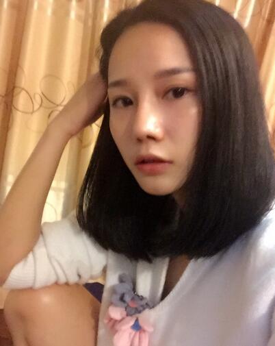 西安陽光整形醫(yī)院邵萍醫(yī)生做鼻綜合整形怎么樣？附鼻綜合整形案例