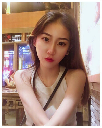 珠海海大整形美容外科黃發(fā)醫(yī)生做面部吸脂怎么樣？附面部吸脂案例