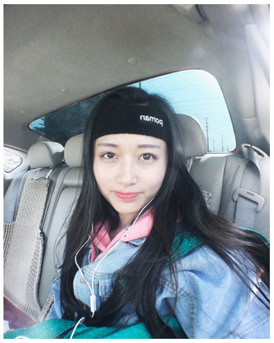 義烏傅氏口腔醫(yī)生朱雨晴做牙齒隱形矯正效果怎么樣？附牙齒隱形矯正案例