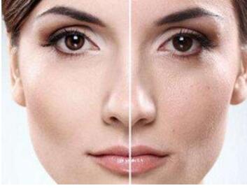 南昌市第二醫(yī)院整形熱瑪吉