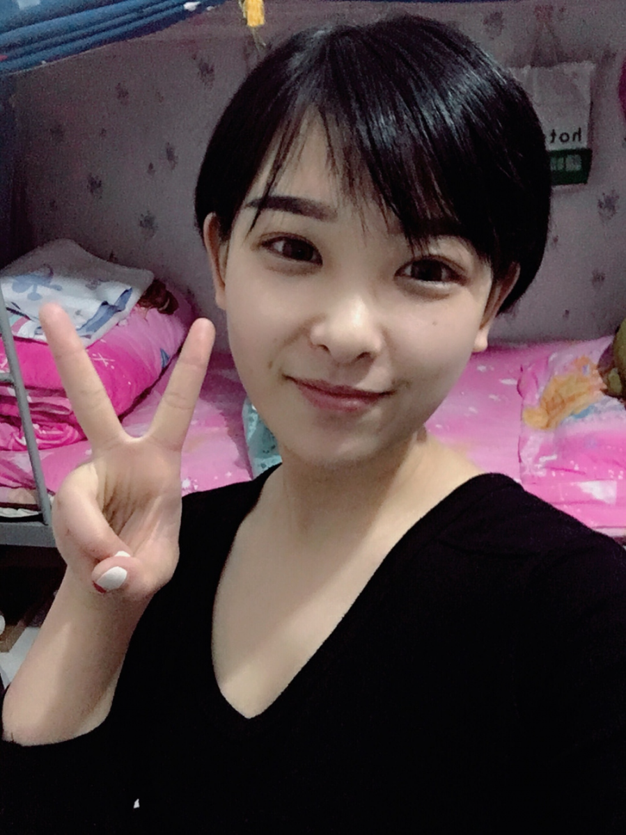 武漢肽慕醫(yī)美整形醫(yī)院楊婉菱醫(yī)生做面部吸脂效果怎么樣？附面部吸脂案例