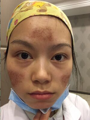 1517898376234473.jpg 1517898376234473.jpg