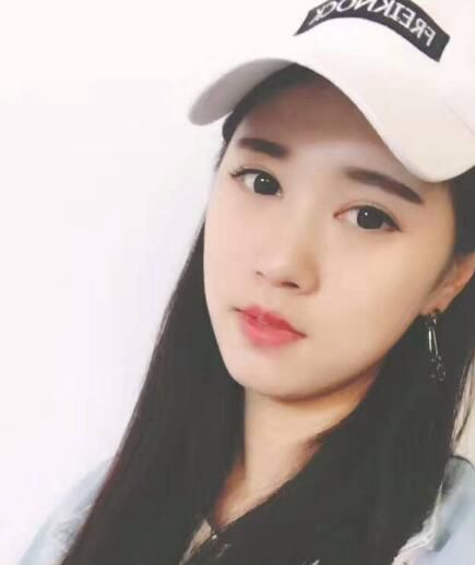 北京亞奧整形醫(yī)生程金龍做韓式三點雙眼皮+開內(nèi)眼角效果怎么樣？