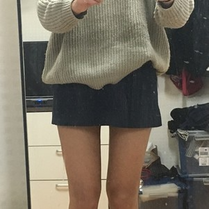 株洲雅美醫(yī)療整形醫(yī)生車旺做大腿吸脂效果怎么樣？附案例效果對(duì)比圖