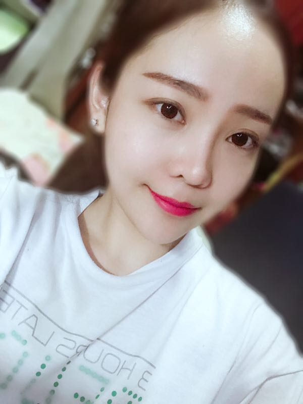 北京可思美醫(yī)療整形醫(yī)生蘇靜做臉部自體脂肪填充效果怎么樣？