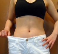 廣州韓佳人整形醫(yī)院詹曉芳做腹部吸脂效果怎么樣？附案例效果對(duì)比圖