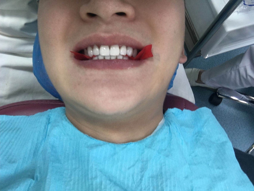 1518415033632659.jpg 1518415033632659.jpg