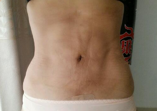 1518401738887294.png 1518401738887294.png