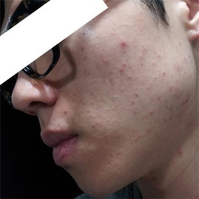 1518489856821221.jpg 1518489856821221.jpg