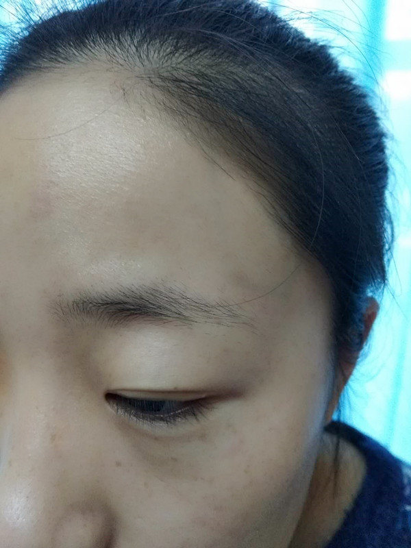 長(zhǎng)沙愛思特醫(yī)療美容醫(yī)院做半永久紋眉怎么樣？附彭子娟醫(yī)生案例效果圖