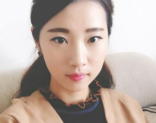 北京亞奧整形醫(yī)生程金龍做韓式三點雙眼皮+開內(nèi)眼角效果怎么樣？