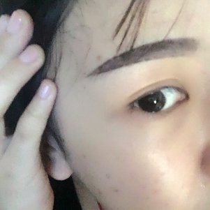 大同清木整形醫(yī)院張樹霞醫(yī)生做半永久紋眉效果如何？附半永久紋眉效果圖
