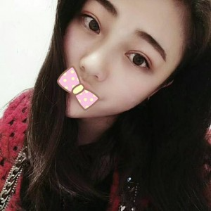 張家口維多利亞整形醫(yī)院張凱醫(yī)生做全切雙眼皮真實(shí)案例效果對(duì)比圖