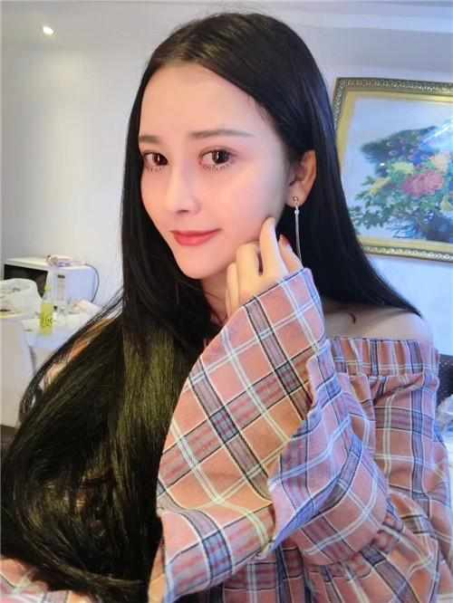 鄭州華領醫(yī)療美容醫(yī)院醫(yī)生張永濤做硅膠假體隆鼻怎么樣？附案例效果對比圖