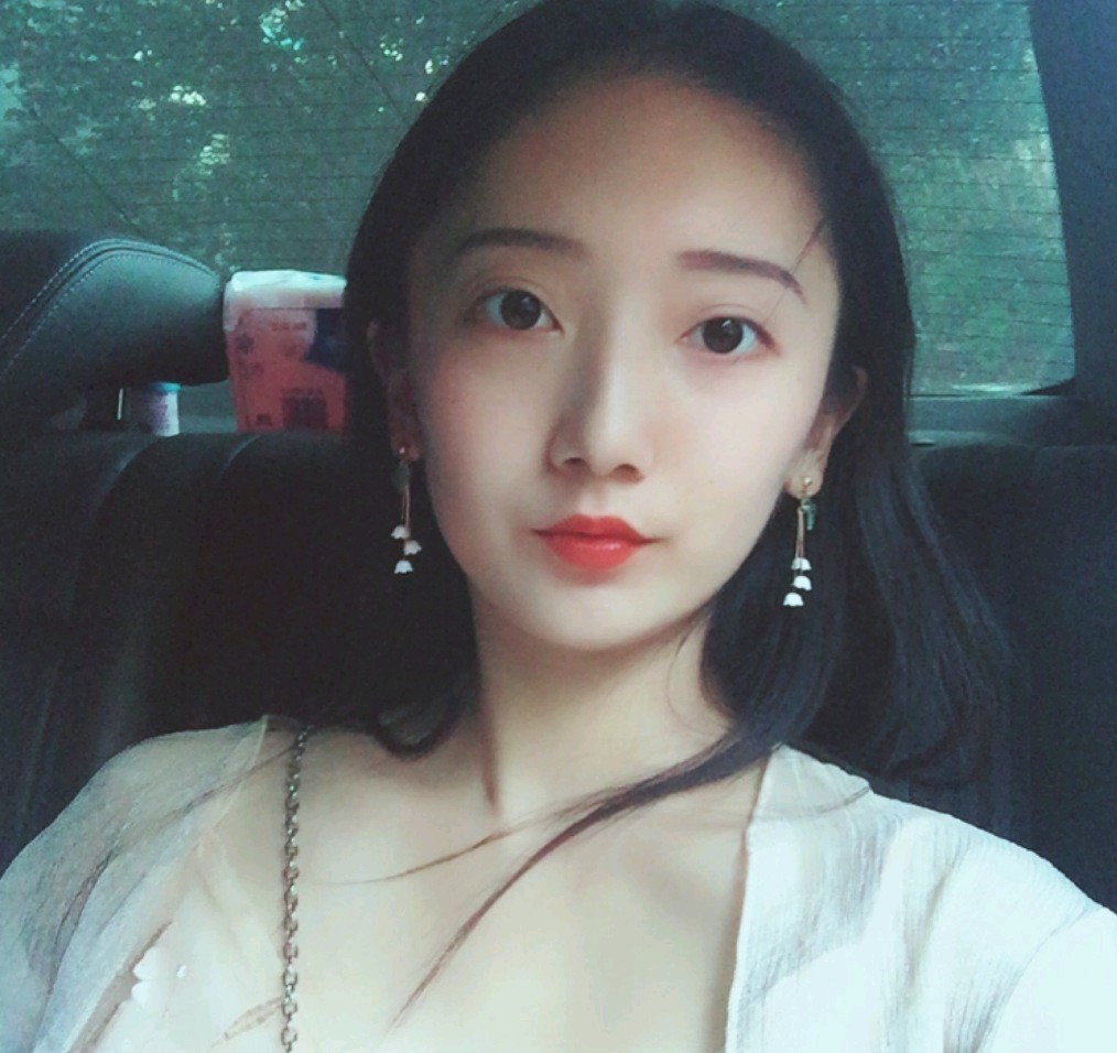 1528264996831345.jpg 深圳鵬愛醫(yī)療美容醫(yī)院醫(yī)生文炯軫做埋線隆鼻怎么樣?附案例