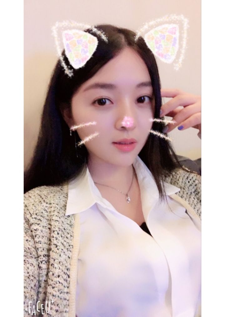 北京京韓整形醫(yī)生王義山做埋線雙眼皮怎么樣？附案例效果對(duì)比圖