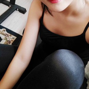 岳陽愛思特醫(yī)療美容醫(yī)院醫(yī)生王福生做手臂吸脂怎么樣？附案例效果圖