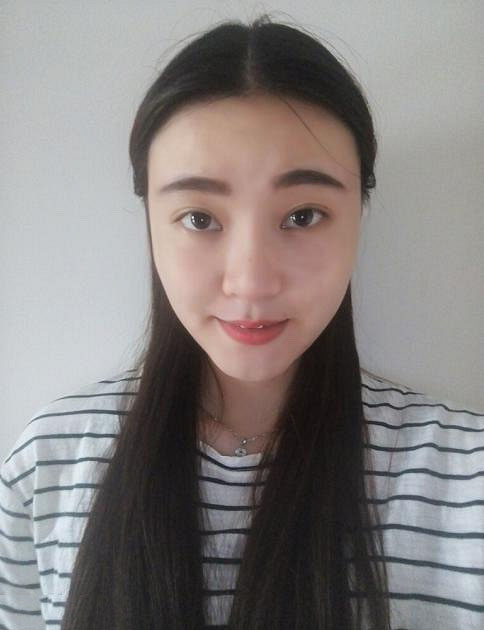 深圳陽(yáng)光整形美容醫(yī)院醫(yī)生張平做膨體隆鼻+雙眼皮+注射瘦臉案例效果對(duì)比圖