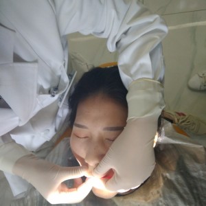 黔西南興義京州口腔醫(yī)院醫(yī)生徐勇做牙貼面怎么樣？附案例效果對(duì)比圖