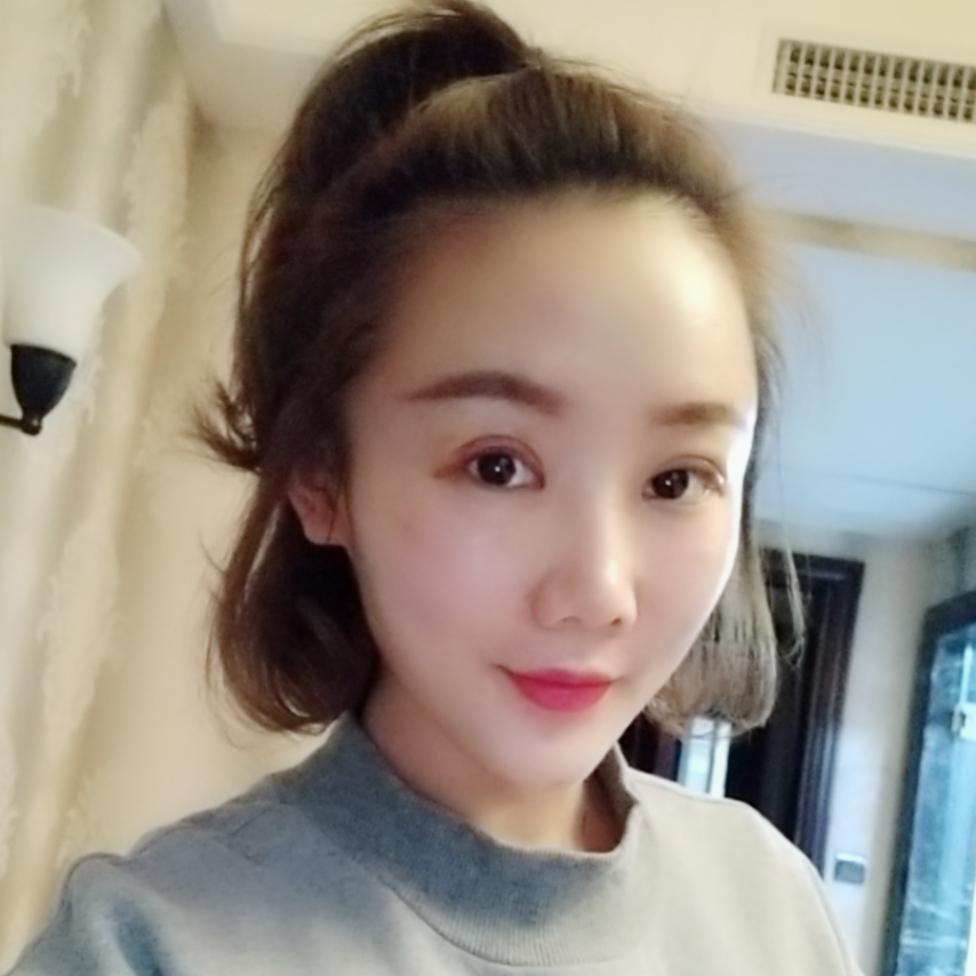 上海首爾麗格整形醫(yī)院醫(yī)生唐鏖做眼綜合+自體脂肪全臉填充案例效果對(duì)比圖