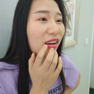 洛陽友好口腔醫(yī)院醫(yī)生李新然做牙貼面怎么樣？附案例效果圖