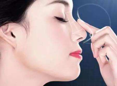 張家港唯恩整形醫(yī)院假體隆鼻