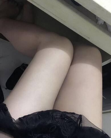 上海保加醫(yī)療美容門診部做大腿吸脂怎么樣？附楊勇醫(yī)生案例效果對(duì)比圖