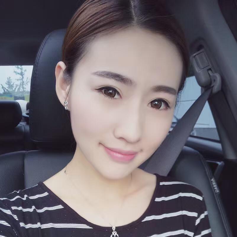 貴陽美和諧醫(yī)療整形醫(yī)生孫澤芳做切開雙眼皮效果怎么樣？附案例效果對比圖