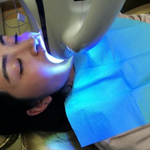 上?？仆呖谇会t(yī)院醫(yī)生鄧建儒做牙齒冷光美白怎么樣？附案例效果對比圖