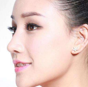 珠海新顏整形下頜角整形