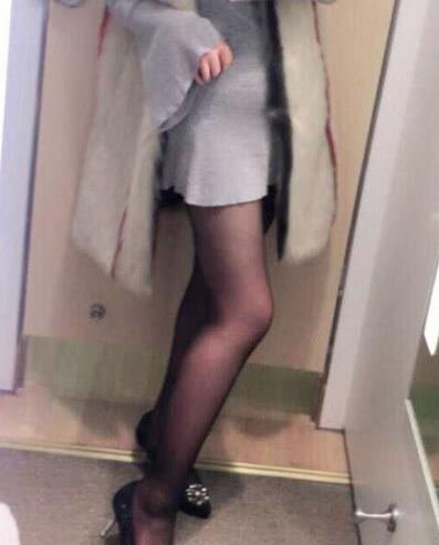 上海保加醫(yī)療美容門診部做大腿吸脂怎么樣？附楊勇醫(yī)生案例效果對(duì)比圖