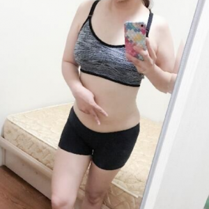 北京可思美整形醫(yī)院醫(yī)生斯勤做腰腹吸脂怎么樣？附案例效果對(duì)比圖